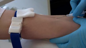 Viete, kto môže darovať krv a za akých podmienok?