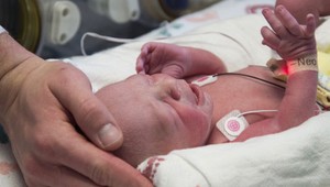 V USA sa narodilo dieťa z transplantovanej maternice