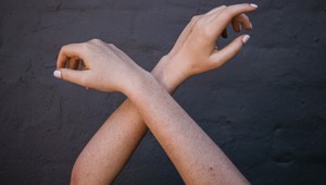 Internetom koluje nová mánia: Tisíce žien má pehu na jednom mieste, máte ju tiež?