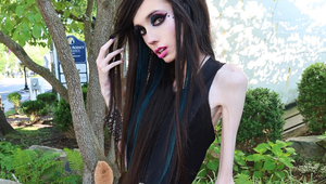 Pohľad na najznámejšiu anorektičku je len pre silné žalúdky: Spod pokožky jej trčia samé kosti!