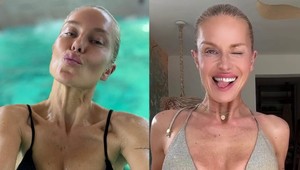 Je celá umelá? Simona Krainová zareagovala na hejty: Otvorene povedala, čo má urobené!