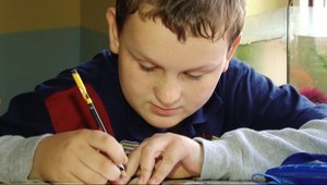 2011 - Srdce pre deti. Jožko (11) chce tvár bez jaziev