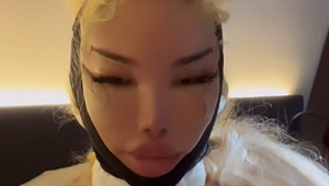 Horor! Po piatom facelifte už plastiková Barbie Alves prestáva vyzerať ako človek!