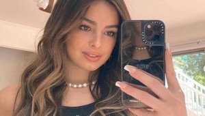 Obrovský vlasový trend je späť: Tento doplnok bude o chvíľu úplne všade!