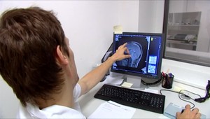 Nemáme peniaze na sociálny balíček ani rekreačné poukazy, hovoria nemocnice