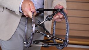 Prelomový softvér: Košická úrazovka zachraňuje končatiny, ktoré by predtým amputovali