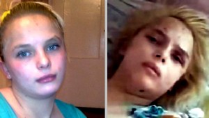 Znásilnili ju a zapálili. Oksana (18) prišla o nohy, aj ruku