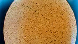 Študent si vycvičil baktérie! Vyrábajú bioplast