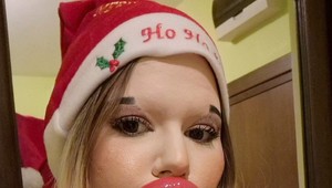 Žena s najväčšími perami na svete šokovala vianočným darčekom: Rodina má o ňu strach!