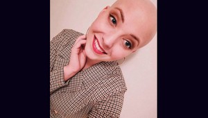 Anička Slováčková bojuje s rakovinou prsníka, pohoršilo sa JEJ!