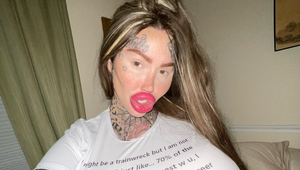 Preslávila sa najtučnejšou vagínou sveta, teraz jej praskol implantát: Veď je to nechutné!