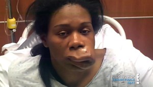 Stanovili jej zlú diagnózu: Pri pohľade na Starrinu sa zaručene zľaknete!