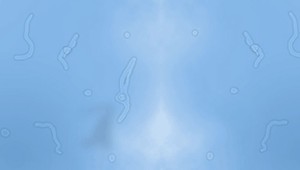 Aj vy vidíte plávajúce vlákna? Sú to kúsky vášho oka