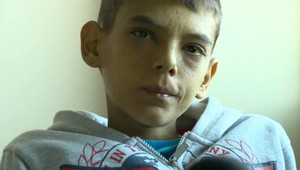 Zákerná choroba Vojtovi zničila život: Má 20 rokov, no vyzerá ako 12-ročný chlapček!