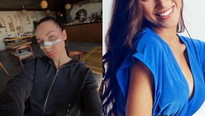 Bianka Rumanová kedysi vs. dnes: Zmenila jej plastika nosa celú tvár? FOTO porovnanie