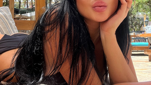 PO útoku psa zostala ZOHAVENÁ: Známa Češka ukázala, čo jej na tvári urobil