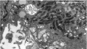 Slovenským vedcom sa podaril vizualizovať koronavírus, pozrite si ako vyzerá
