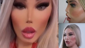 Čakala obdiv, naháňa STRACH. Z muža sa stala žena, zo ženy plastikové monštrum