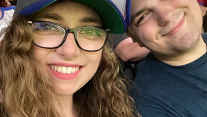 Prežila útok psov, ktorí jej roztrhali tvár: Jej FOTO sú len pre silné žalúdky!