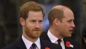 Harry plešivie ako jeho brat, podstupuje drahú procedúru