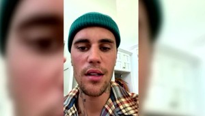 Paralyzovaná tvár Justina Biebera: Ramsay-Huntov syndróm môže byť nebezpečný