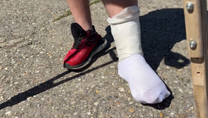 Konflikt pre inú cenu jazdy v taxíku? Klient skončil so zlomenou nohou a monoklom