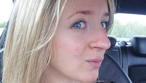 Nenávidela svoj “Pinocchio” nos, operácia jej zmenila život: WAU, to je ale rozdiel!