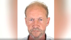 Polícia hľadá muža po operácii hlavy, o pomoc prosí aj verejnosť