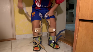 Problémy "palčekov": Liek im ponúka lepšiu budúcnosť, no poisťovne ho nepreplatia