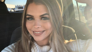 Žena ukázala svoju tvár PRED a PO tehotenstve: Aj vám sa stalo to isté, čo jej?