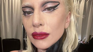 Za dobrotu... Chránil psov Lady Gaga vlastným telom, tá ho odstrihla od pomoci, musí pýtať od cudzích!