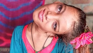 Po ťažkej nehode v detstve žila s hlavou nakrivo: Pozrite sa, ako vyzerá po riskantnom zákroku