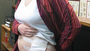 10 varovných príznakov zlyhávajúcich obličiek: Na tieto signály si dajte pozor!