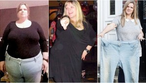 Mala brucho, ktoré by jej závidel aj Santa: Schudla 40 kíl a konečne sa zmestí do šiat