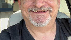 Obľúbený český herec vydesil štrbavým úsmevom! So šušľaním by to pred kamerou nešlo!