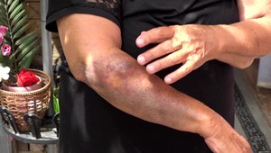 Sestry sa pohádali až tak, že jedna na druhú zaútočila lopatou