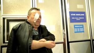 Policajti v akcii, Stanislavovi mali vybiť oko