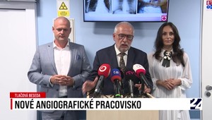 Tlačová beseda o novom angiografickom pracovisku