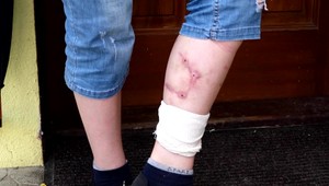 Pes pohrýzol dieťa až do krvi. Polícia najprv obvinila maloletého