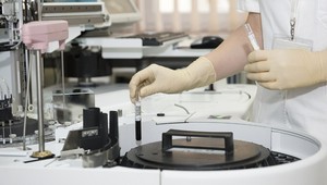 V USA schválili nový rýchlotest na koronavírus: Výsledky poskytuje už za 45 minút