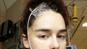 Seriálová hviezda šokuje! Pre dve aneuryzmy prišla o časť mozgu!