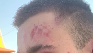 Na zastávke sa spustila brutálna bitka. Vek útočníkov vás prekvapí