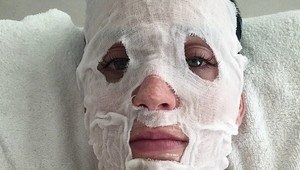 Ktorá slávna speváčka podstupuje takúto strašidelnú procedúru?