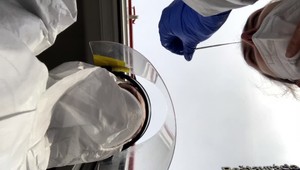 V Česku hlásia prvého očkovaného, ktorý sa infikoval juhoafrickým variantom