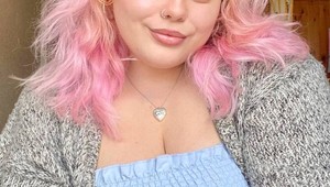 Roky sa za TO hanbila, dnes sa už neskrýva: Na jej tvári si všetci všimnú iba jednu vec