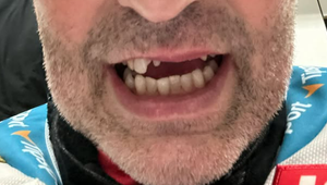 Ten ale dopadol! Jágr prišiel o komplet predné zuby, jeho reakcia je šokujúca!