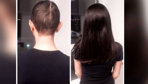 Tisíce Slovákov prišli o vlasy, aby pomohli. Byť darcom ale nie je jednoduché