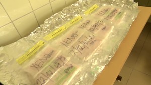 V bratislavskej nemocnici používajú na popáleniny biologický obväz z ošípaných