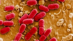 E-coli prekročila hranice Európy! Prvý prípad v Kanade