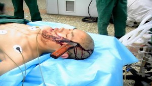 Do hlavy sa mu zavŕtala 14 centimetrová čepeľ. Prežil!